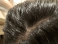 ヘアフォーユー2%(女性向け)-いいです